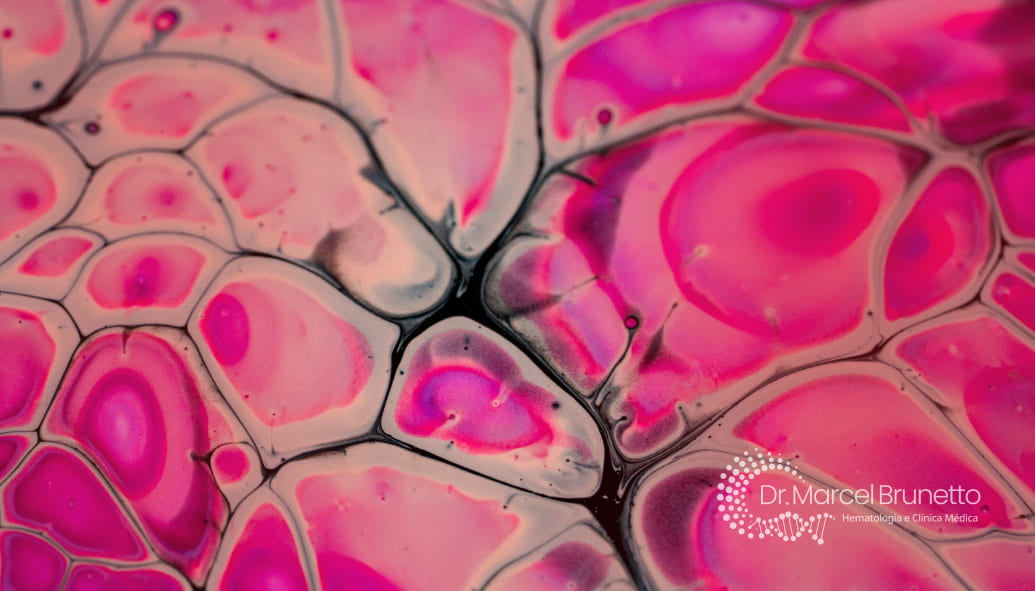 Neoplasias de Células Plasmáticas
