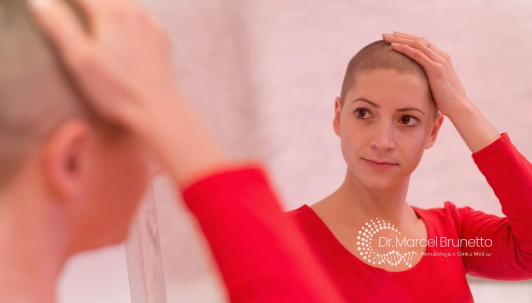 Quimioterapia e Queda de Cabelo